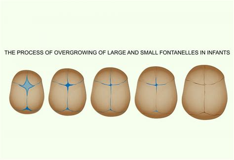 Fontanelles On Newborn Head: Reasons, Signs & Treatment