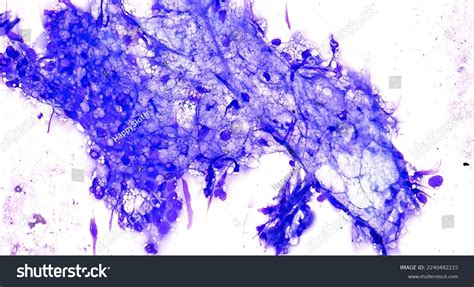 Sebaceous Cyst Dog Cytology