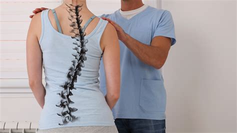 What is Degenerative Scoliosis? - Precision Spine Care