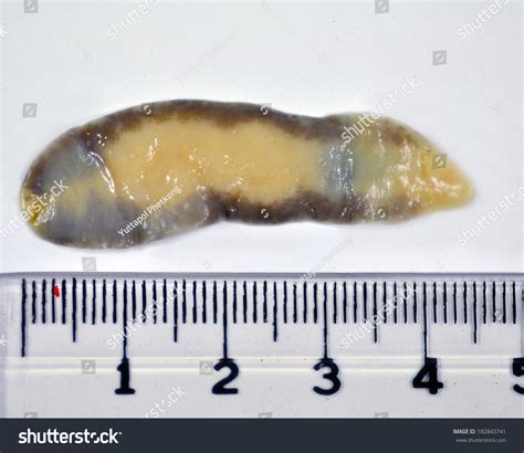 Fasciolopsis Buski Scale Stock Photo 182843741 - Shutterstock