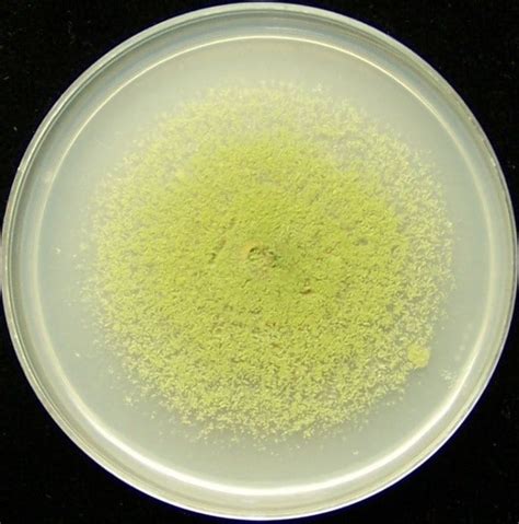 Aspergillus Flavus - Symptoms, Disease, & Treatment | Mold Busters