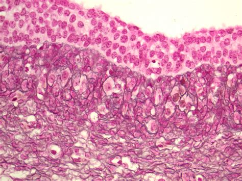 Follicular Cyst