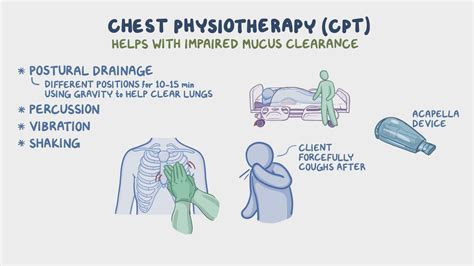 Respiratory: Chest physiotherapy - Osmosis Video Library