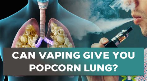 Can Vaping Give You Popcorn Lung?