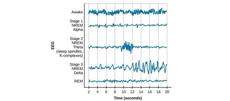 Sleep and EEG – Introduction to Neuroscience