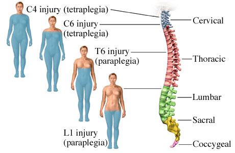 Spinal Cord Injury Flashcards | Quizlet