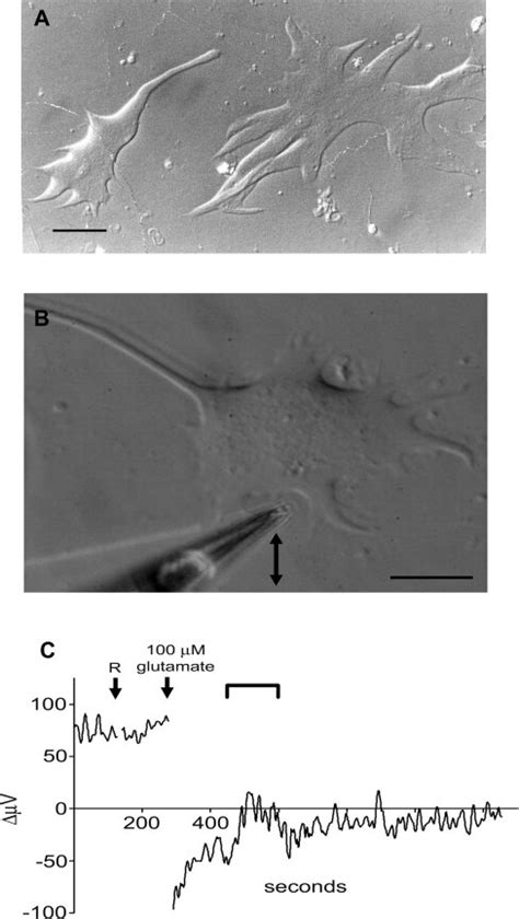 (A) Photomicrograph of a cone (left) and rod (right) horizontal cell... | Download Scientific ...