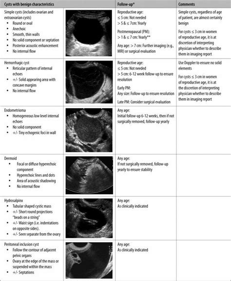 Ovarian Torsion – Sonographic Tendencies