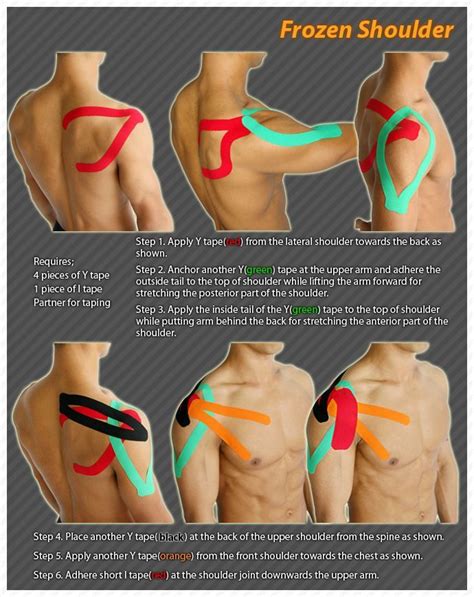 bae31139e3bc6ec9d09e07a13adb75f0.jpg 690×870 pixels | Kinesiology taping, Shoulder exercises ...