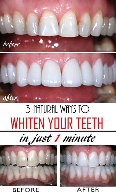 3 Natural Ways to Whiten Teeth at Home | Wellness Cool