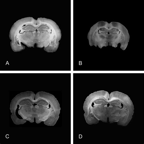 Photomicrographs showing horseradish peroxidase staining in brain... | Download Scientific Diagram