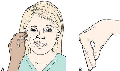 Hypocalcemia | Current Health Advice, Health Blog Articles and Tips