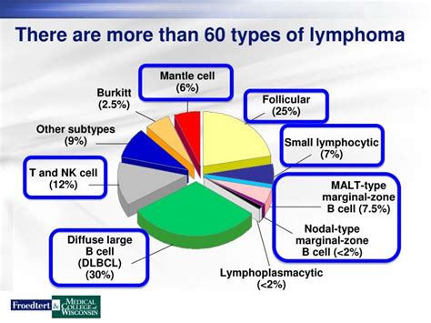 PPT - Lymphoma Overview PowerPoint Presentation - ID:4501266