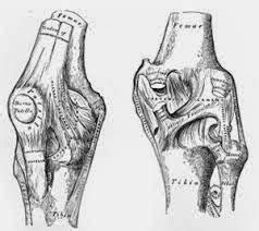 Medical Treatment Pictures-for Better Understanding: Arthroscopic Knee Synovectomy Surgery ...