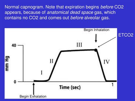 PPT - Capnography PowerPoint Presentation, free download - ID:5378861