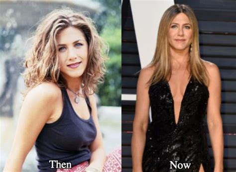 Jennifer Aniston Plastic Surgery Before and After Photos