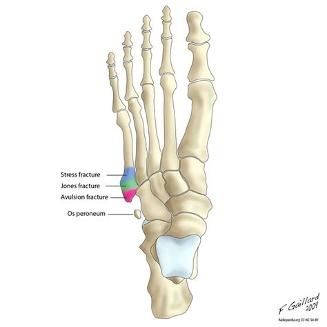 Ashtone Morgan undergoes foot surgery - Waking The Red