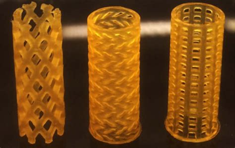 3D-printed bioresorbable airway stent | Innovationsgesellschaft mbH