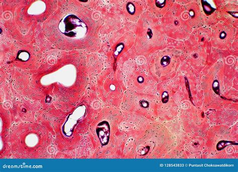 Histology of Human Compact Bone Tissue Under Microscope View for Stock ...