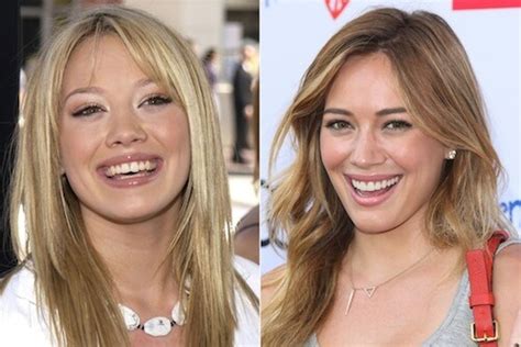 Which Celebrites Have Veneers? | Celebrity Smiles | Charlotte Dentist