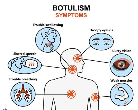 Botulism - MEDizzy