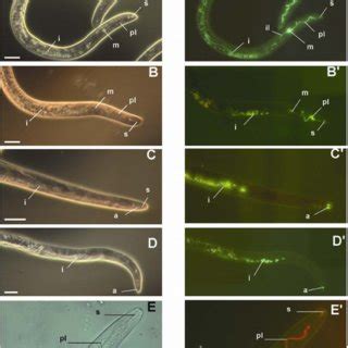 Fluorescence microscopy showing fluorescein isothiocyanate (FITC) and ...