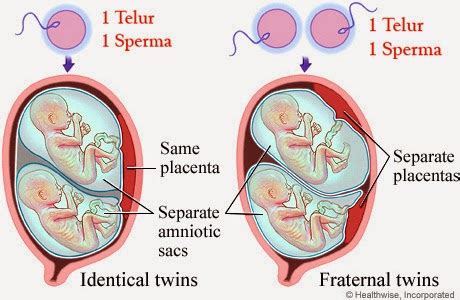 Proses Terbentuknya Bayi Kembar - Alif Meylinda