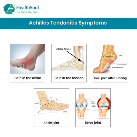 Achilles Tendinitis Types Symptoms Causes Diagnosis – NBKomputer