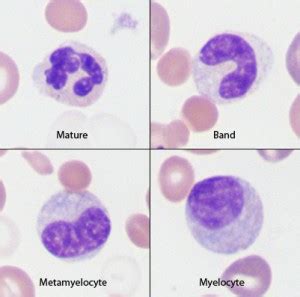 Stages of neutrophil maturity | eClinpath