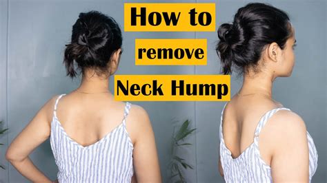 Easy Exercises to Get Rid of the NECK HUMP | Pain Free for Life Pilates