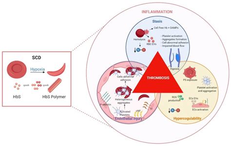 IJMS | Free Full-Text | Sickle Cell Disease: A Paradigm for Venous ...