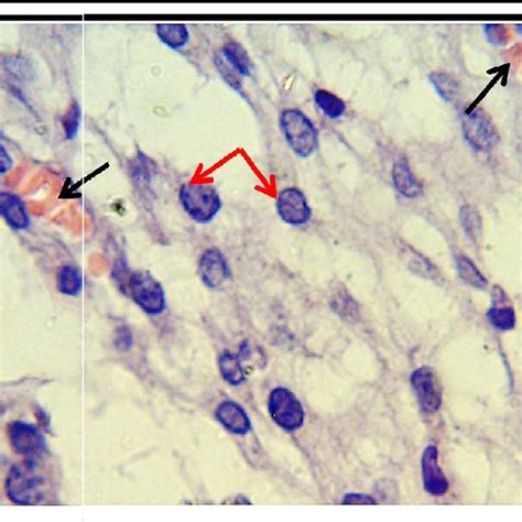 section of mesenchymal tissue in old) shows: (Black arrows) | Download Scientific Diagram