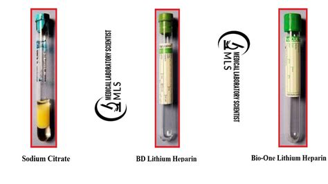 T-SPOT. Test For Mycobacterium Tuberculosis - Medical Laboratory ...