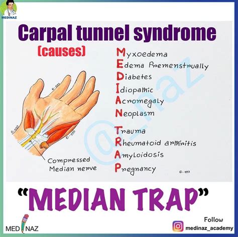 Carpal Tunnel Syndrome Causes