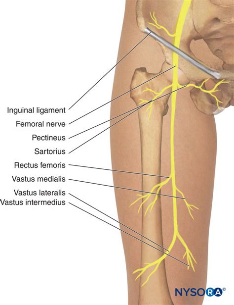 Regionalanästhesie-motorische-Äste-des-femoralen-Nervs - NYSORA