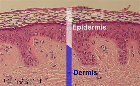 File:Epidermis-delimited.JPG - Wikimedia Commons