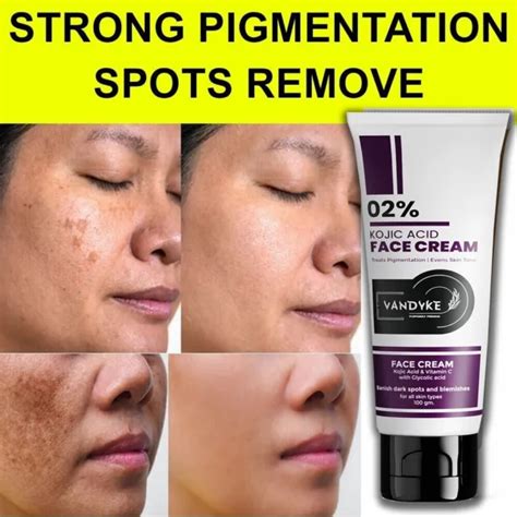 STRONG MELASMA PIGMENTATION Spots Remover Kojic-Acid Cream 100gm For Women & Men $18.79 - PicClick
