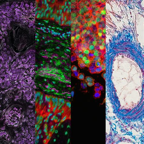 Lung Cells – CellulArt