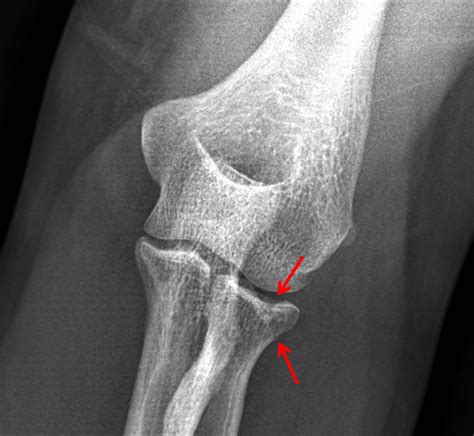 CaseStacks.com - MSK Radiograph Case #6