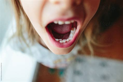 "Closeup Of Little Kid With Extra Teeth In Mouth" by Stocksy Contributor "Maria Manco" - Stocksy