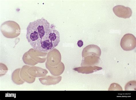 Light micrograph of a normal blood smear showing platelets, a leukocyte and red blood cells ...