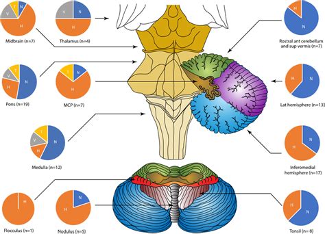 Breakdown of nystagmus characteristics by stroke location. [Pie chat... | Download Scientific ...