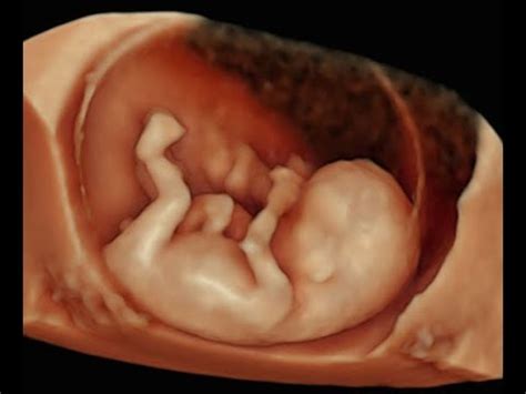 How to Perform 3D Scan of the Baby at 12 Weeks of Pregnancy - YouTube