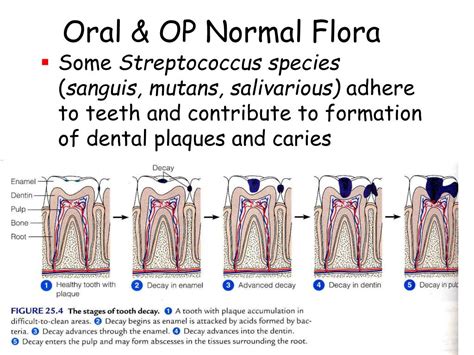 PPT - Normal Flora PowerPoint Presentation, free download - ID:6597076