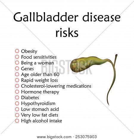 Gallbladder Disease Vector & Photo (Free Trial) | Bigstock