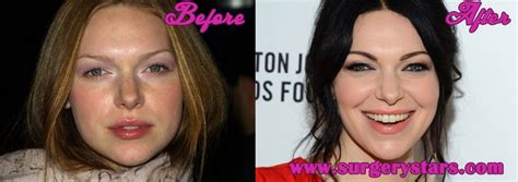 Laura Prepon Plastic Surgery Before and After Pictures