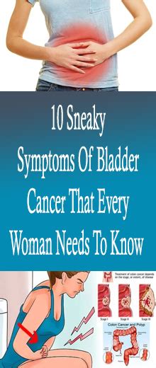 10 Sneaky Symptoms Of Bladder Cancer That Every Woman Needs To Know - articleremedies24