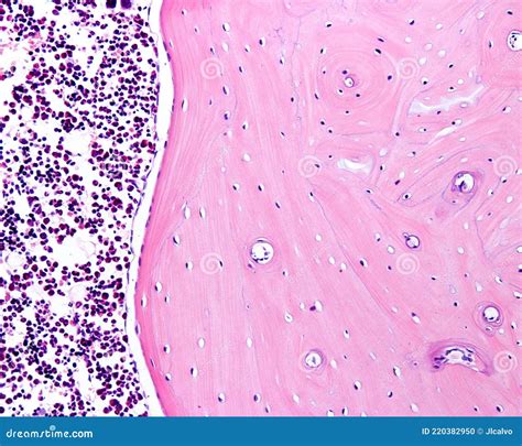 Cortical Bone Histology