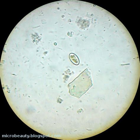 The Wonderful Microworld: Microorganisms in water.