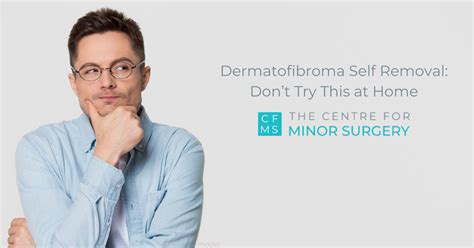 Dermatofibroma Self Removal: Don’t Try This at Home – Centre for Minor ...